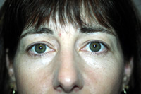 Pre Upper/Lower Liner