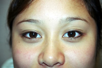 Post liner