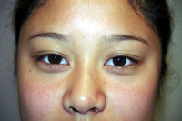 Pre liner